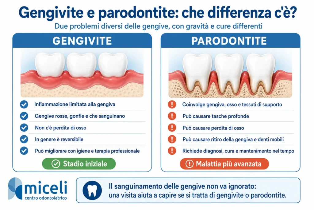 Infografica sulla differenza tra gengivite e parodontite con sintomi, perdita di osso e principali caratteristiche