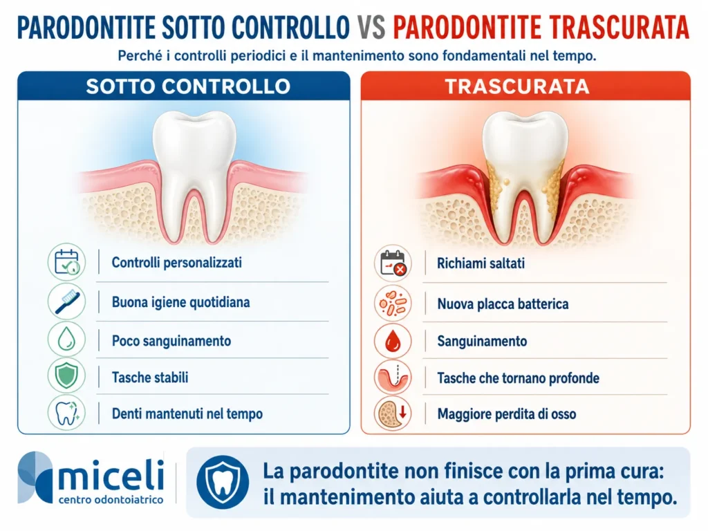 Infografica sulla parodontite sotto controllo e sulla parodontite trascurata con confronto tra mantenimento regolare e peggioramento nel tempo