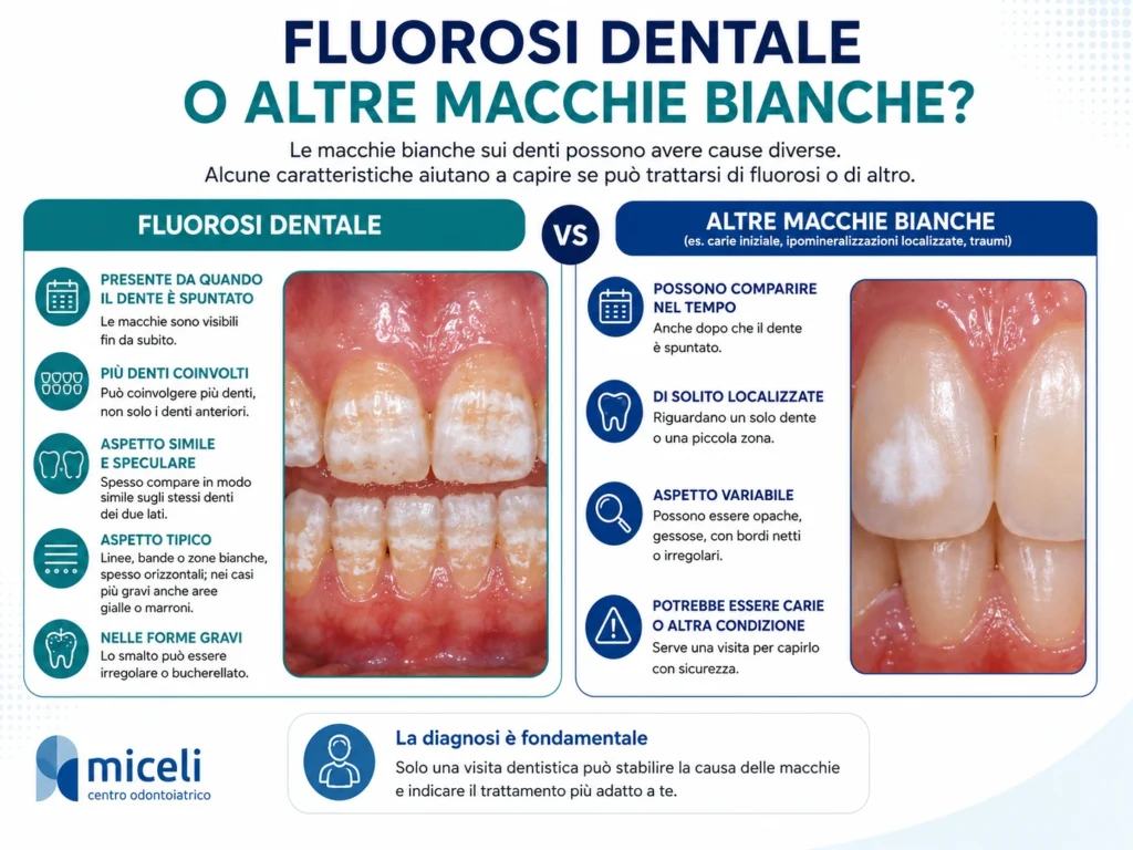 Differenza tra fluorosi dentale e altre macchie bianche sui denti