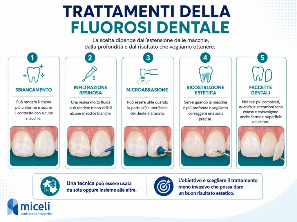Trattamenti della fluorosi dentale