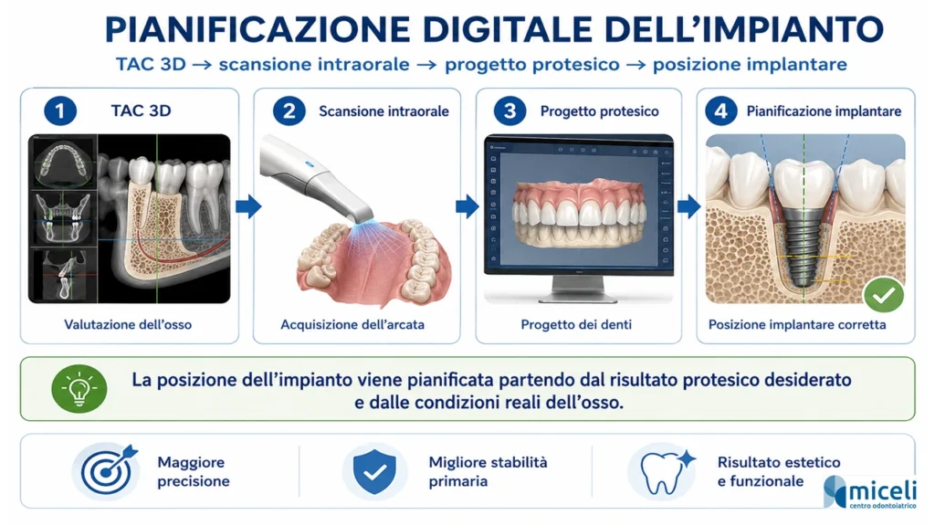 Infografica sulla pianificazione digitale dell’impianto con TAC 3D, scansione intraorale, progetto protesico e posizione implantare corretta